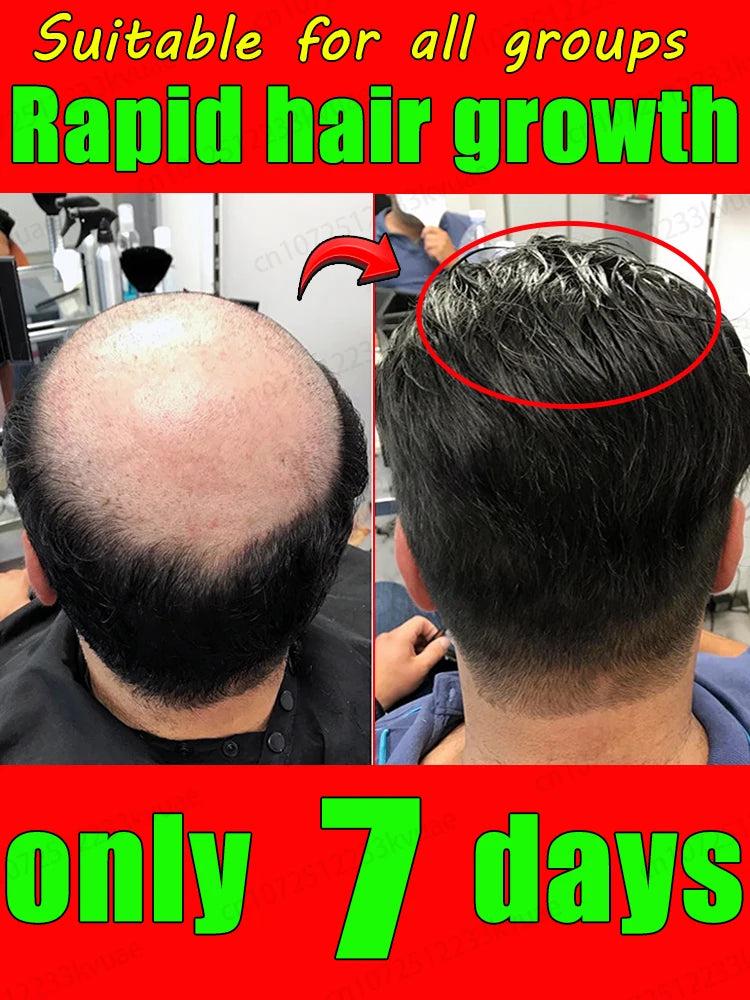 Hair Growth