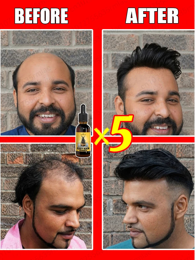 Hair Growth