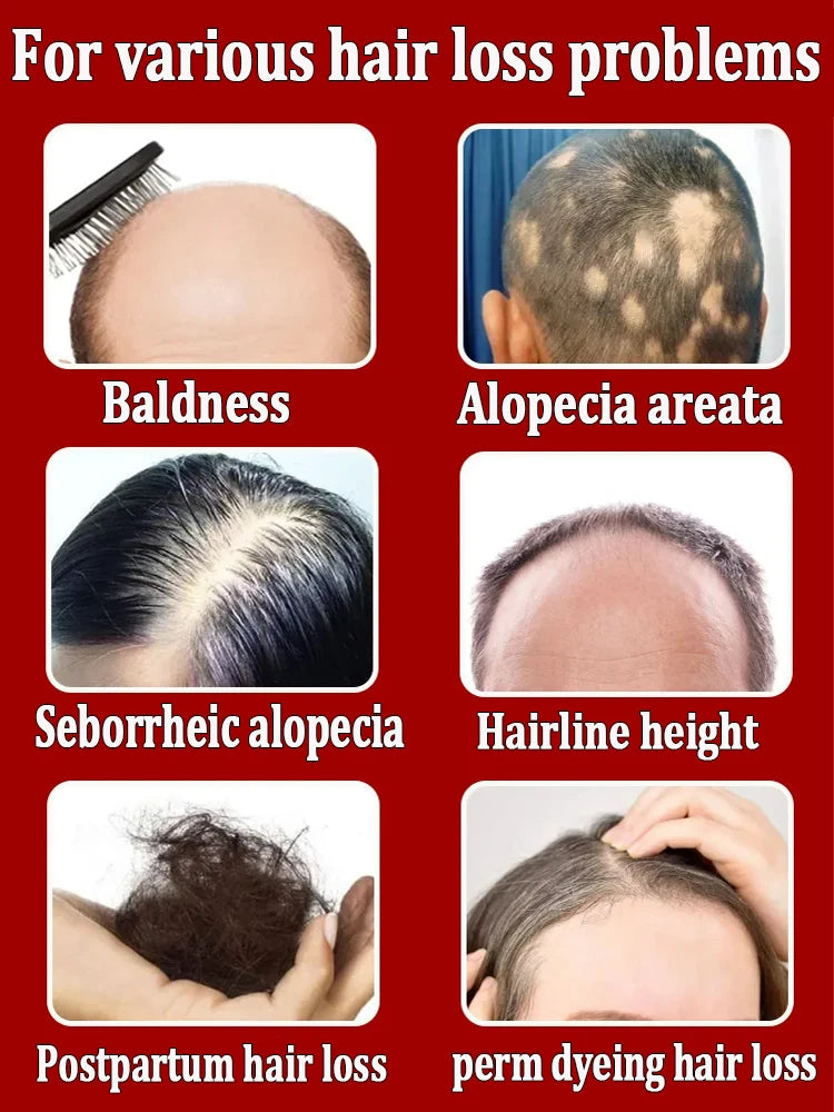 Hair Growth